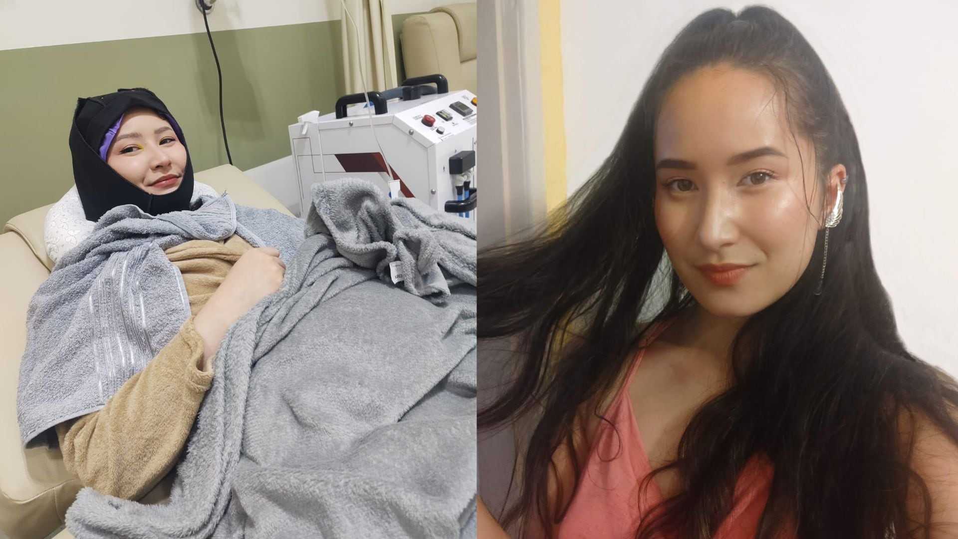 Entre a quimioterapia e o espelho: como mulheres que tratam o câncer lidam com a queda de cabelo e encontram formas de se reconhecer